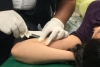 Previenen embarazo adolescente en la UAEMex con implante subdérmico
