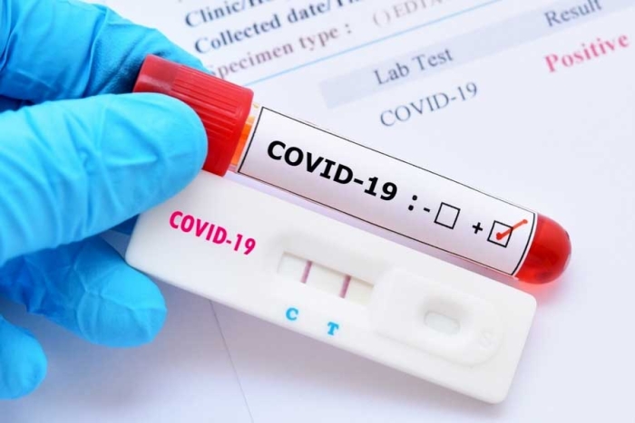 Aumenta demanda de pruebas Covid en clínicas privadas
