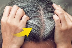 ¿Por qué el estrés hace que salgan canas?