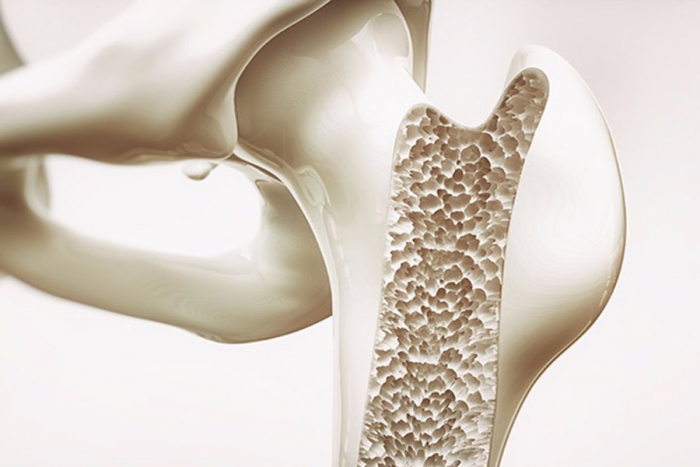 Osteoporosis, ¿puede darse durante el embarazo?