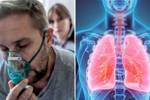 Un diagnóstico temprano de cáncer de pulmón ayuda a superar tres años de vida