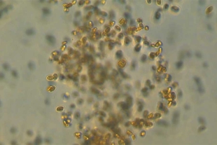 Descubren un depredador microscópico capaz de capturar carbono