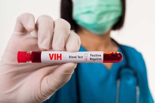 Primera mujer curada del VIH gracias a células madre de cordón umbilical