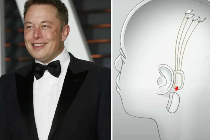 FDA autoriza a Neuralink, de Elon Musk, ensayar implantes cerebrales en humanos