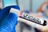 Detectan en Nayarit primer caso de “flurona”