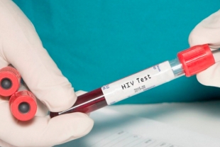 Confirmada la cura de un segundo paciente con VIH