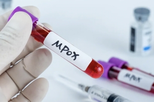 En las últimas dos semanas, registra Ssa 128 nuevos casos de mpox