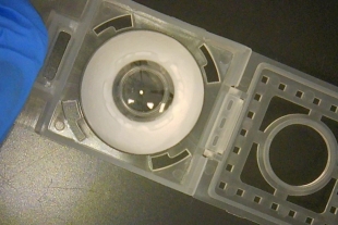 Le implantan córnea artificial y le devuelve la vista a un ciego