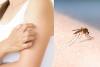¿Porqué los mosquitos pican más a unas personas que a otras?