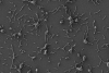 Científicos españoles modifican bacteria para tratar infecciones resistentes a antibióticos