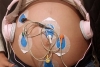 Investigadores UAEMéx revisan efecto de la música en actividad cardiaca fetal