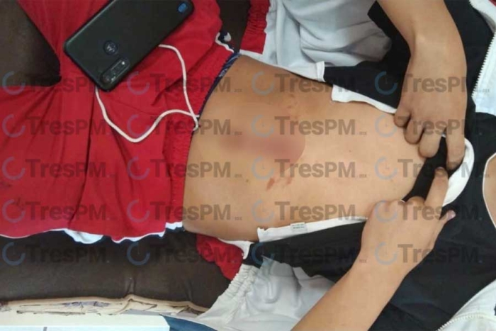 Estudiante lesiona a su compañero con arma blanca en secundaria de Toluca
