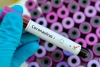 El Edoméx está preparado para atender casos de coronavirus