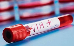 Gobierno garantiza acceso a servicios médicos para pacientes con VIH-Sida