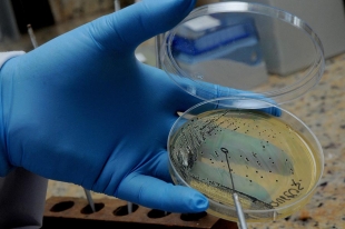 Alerta comunidad científica sobre la resistencia antimicrobiana