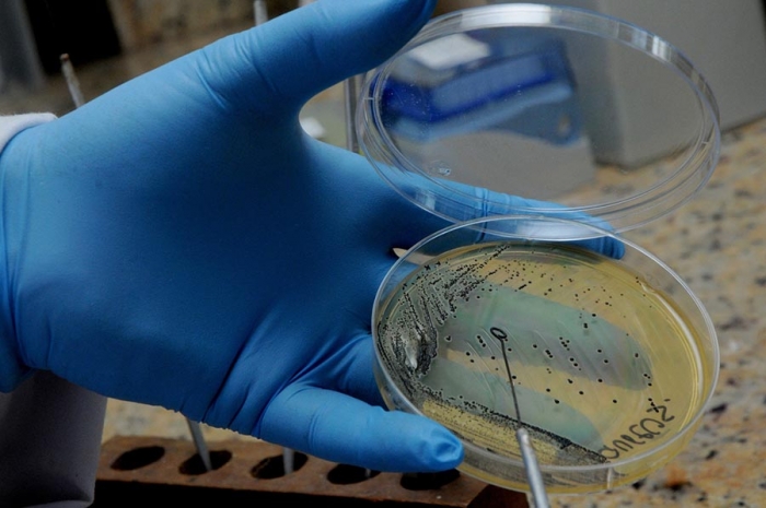 Alerta comunidad científica sobre la resistencia antimicrobiana