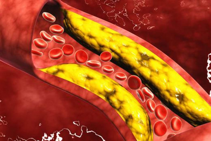 Prevé el aumento de colesterol con estos alimentos