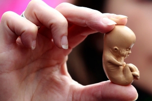 Formaliza PRD propuesta para despenalizar el aborto