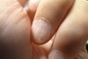 Las uñas también nos avisan de algunas enfermedades